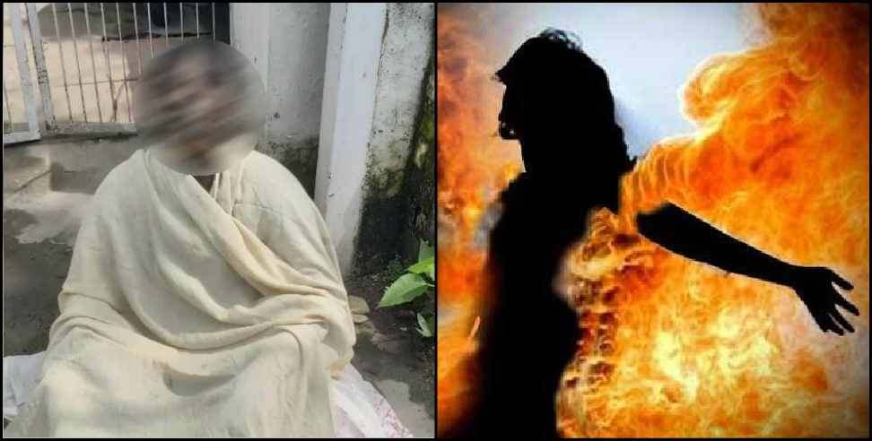 Dehradun News: Woman set herself on fire in Dehradun