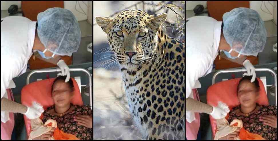 Pithoragarh News: Pithoragarh women fight with leopard