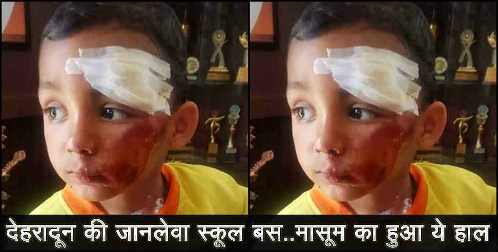 उत्तराखंड: dehradun school boy fallen from bus