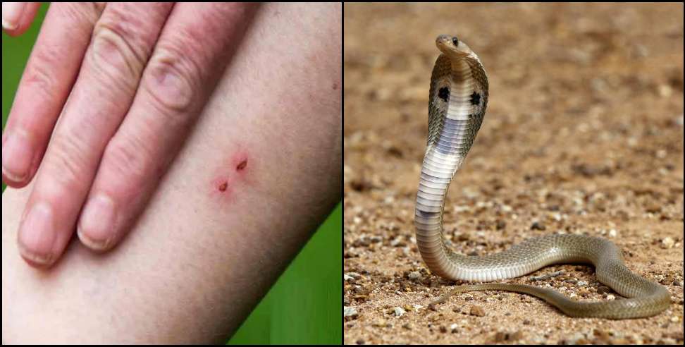uttarakhand snake bite: Many people died due to snake bite in Uttarakhand