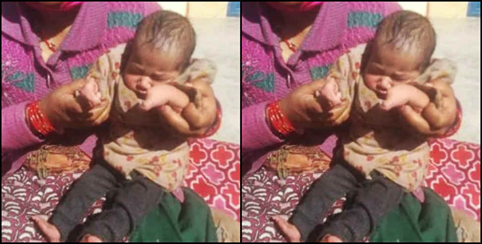 Tehri Garhwal: Family sought financial help for a disabled child from birth