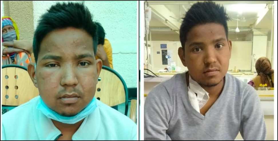 mayank jagwan rudraprayag: Appeal for help for Mayank Jagwan of Rudraprayag