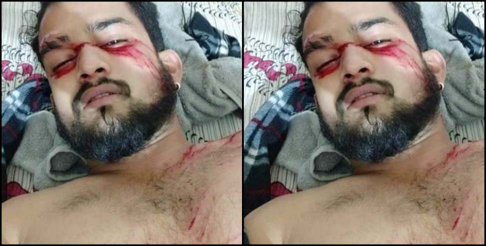Greater Noida Deepak Phulara: attack on Deepak Phulara in Greater Noida