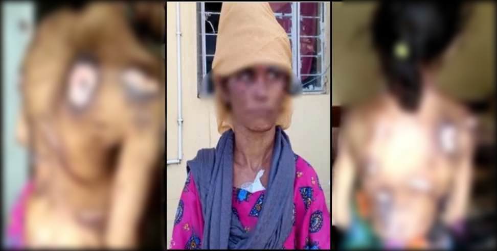 Preeti was harassed by her in-laws in Vikasnagar