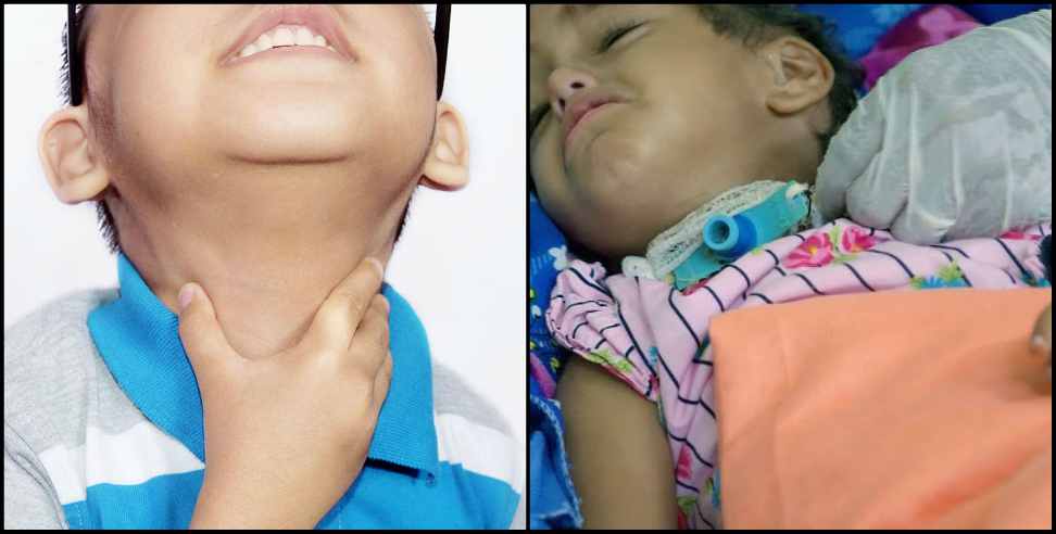 Bageshwar News: Diphtheria disease in Bageshwar