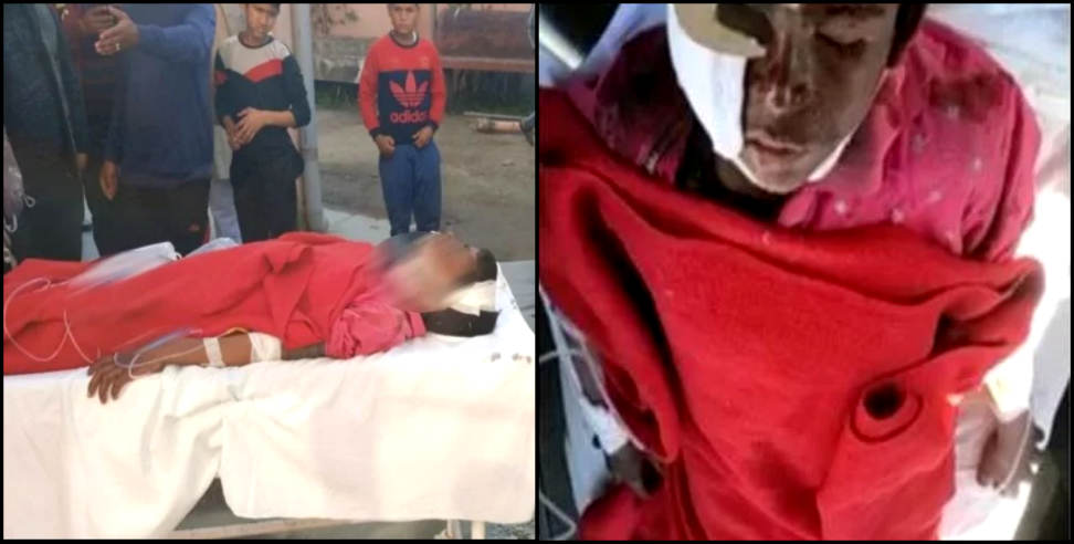 Tehri Garhwal: Drunken man shot the boy in tehri Garhwal