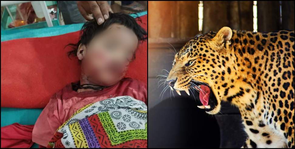 udham singh nagar leopard anandi joshi: Leopard attack on 10-year-old Anandi Joshi in Udham Singh Nagar
