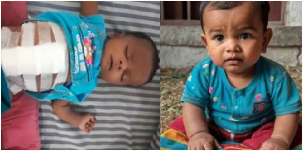 Himalayan Hospital Jolly Grant: Human Fetus Found Stomach of 7 Month Old Baby in Uttarakhand