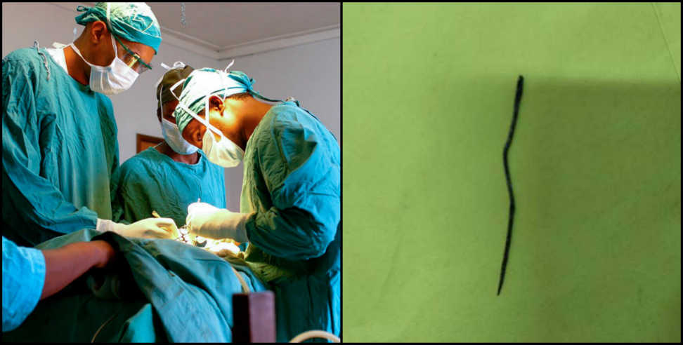 बच्चे के फेफड़े में ढाई इंच की सुई: Doctors removed the needle after performing lung operation
