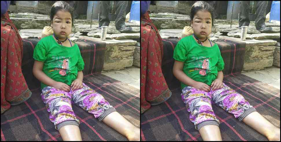 Aarushi Rudraprayag: Help arushi of rudraprayag district