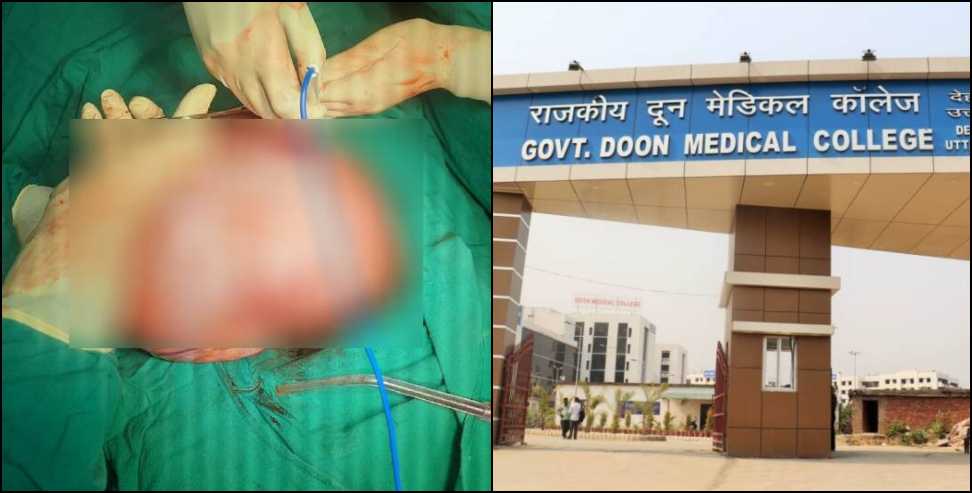 Doon Medical College: Rare Tumor Successfully Removed at Doon Hospital