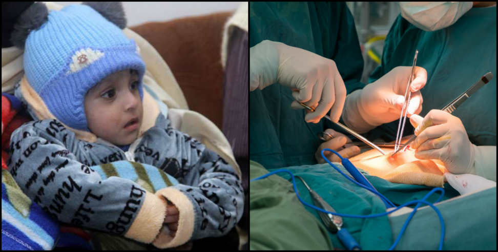 surgery of diet tube: Successful surgery of one year old child made a diet tube