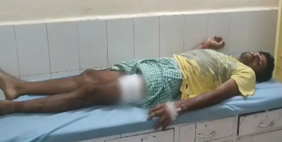 khatima labror firing: Youth fired on laborer in Udham Singh Nagar