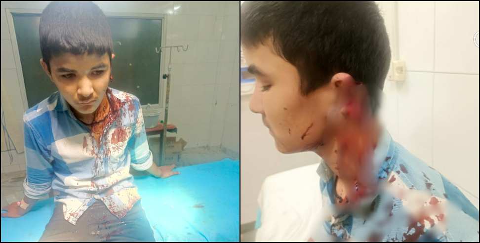 Molestation of Minor: Father and son cut off the ear of a minor with sickle