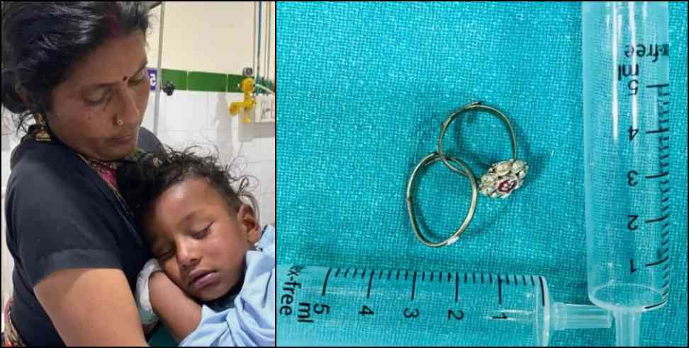 boy swallowed toe ring : 3 year old boy swallowed toe ring Bageshwar