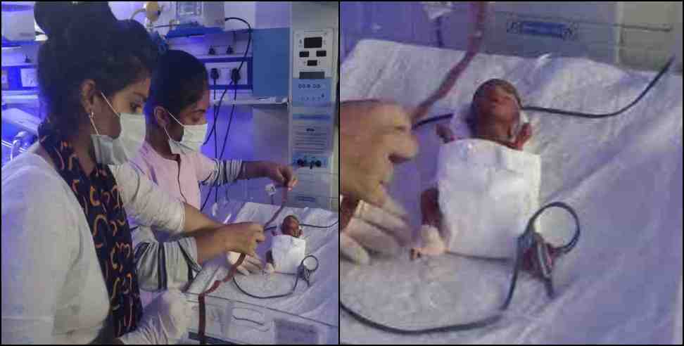Youngest child born in India news: Youngest child born in India admitted in kashipur uttarakhand