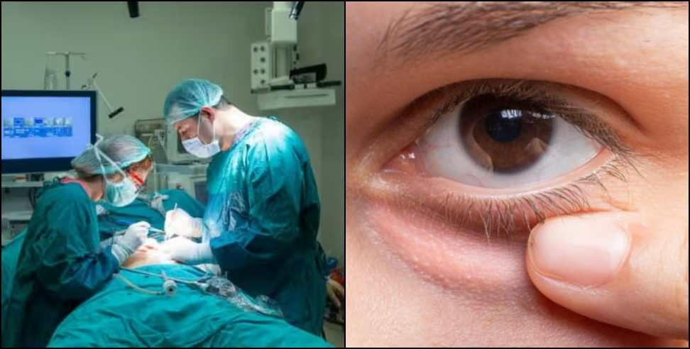 Uttarakhand First Eye Tumor Patient: Successful surgery of first eye tumor patient of Uttarakhand