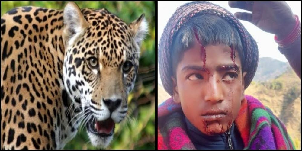 Leopard attack rudraprayag : Guldar attack on student going for exam in Rudraprayag  life barely saved