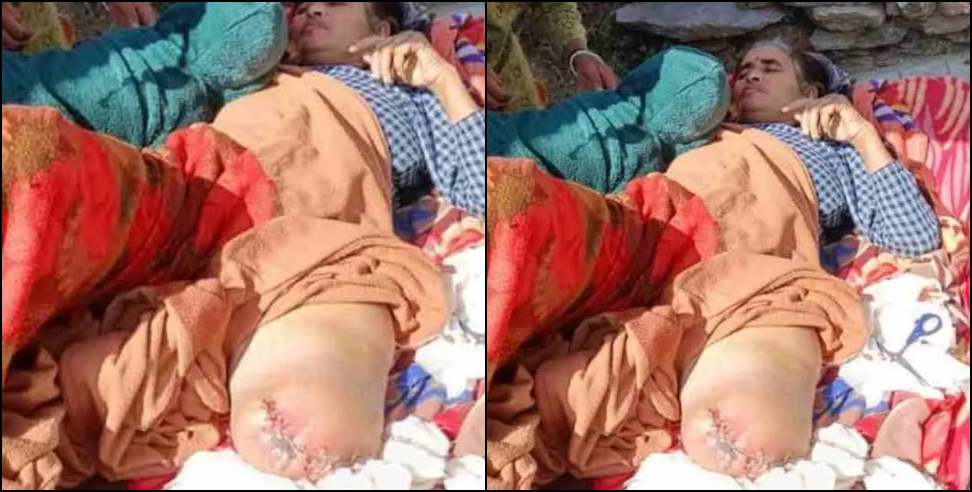 Medical Negligence Case: Woman loses leg due to negligence of doctors