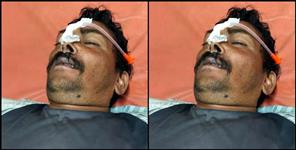 image: Former village head ate poison in Almora