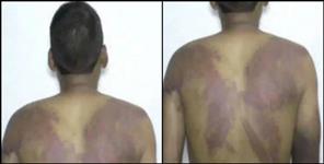 image: Case registered against the ranger and employees of forest department