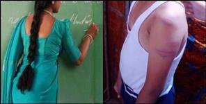 image: Government Inter College Bageshwar Female Teacher Beaten Student
