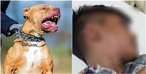 image: Pitbull enjured primary school innocent child in haridwar