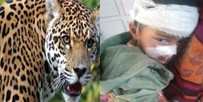 image: Guldaar Attack Five Year Old Child In Rudraprayag