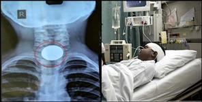 image: rishikesh aiims doctors good work