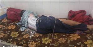 image: Chamoli Garhwal youth Scorched due to electric current