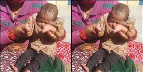 image: Family sought financial help for a disabled child from birth