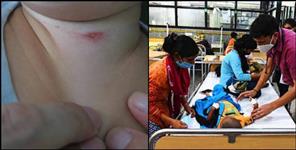 image: Scrub typhus in uttarakhand