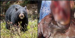 image: Bear attack on youth in Pauri Garhwal