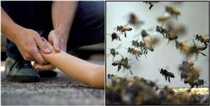 image: Bees attack on family in Champawat
