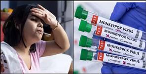image: Monkeypox in Uttarakhand know symptoms and home remedies