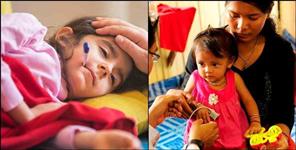 image: First case of meningitis came in Uttarakhand