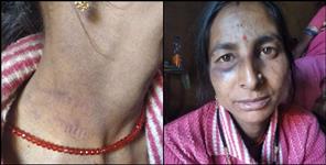 image: Story of Pauri Garhwal Anju Devi