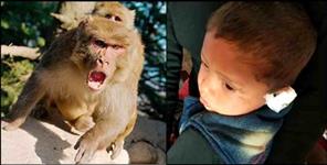 image: Monkey bites child ear in Pithoragarh Berinag
