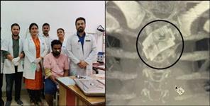 image: Dehradun doctors removed blade from alimentary canal of patient