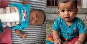 image: Human Fetus Found Stomach of 7 Month Old Baby in Uttarakhand