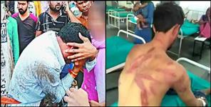 image: Couple beaten by family of girl in kashipur