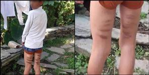 image: Teachers beat student in okhalkanda school