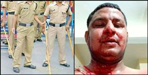 image: Deadly attack on PRD jawan in Bageshwar