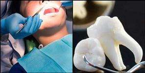 image: Pauri Garhwal District Hospital Dentist News