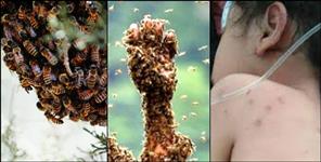 image: Father Son Died cause of Wasp Bite in Tehri Garhwal