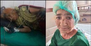 image: Rethi Devi scorched in Uttarkashi forest fire