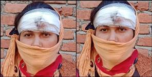 image: Attack on Rajmati Bisht in Dharchula of Pithoragarh