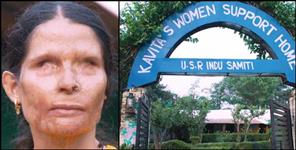 image: Story of acid attack survivor Kavita bisht of ranikhet almora