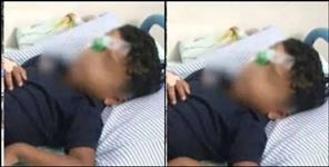image: Class teacher Abha Sharma broke Alias eye in Kashipur
