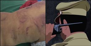Dehradun Man Alleges Brutal Assault Police Launch Investigation